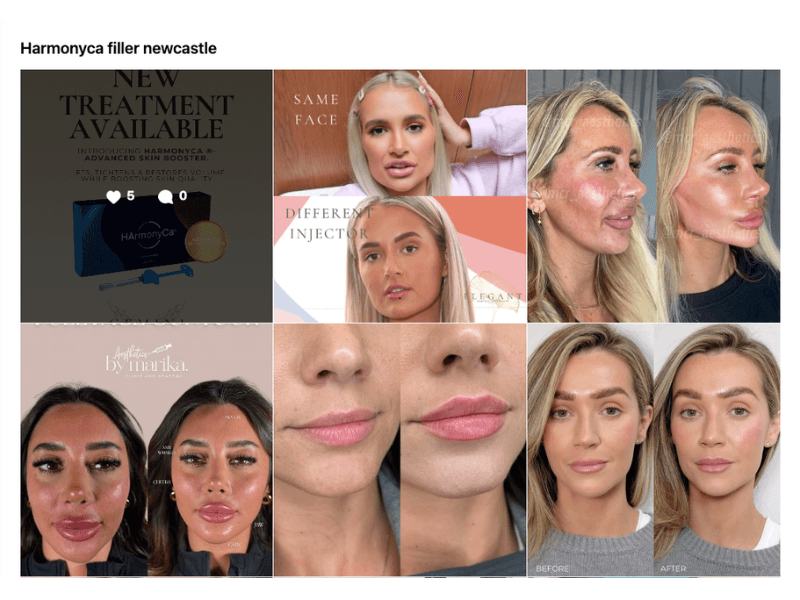 Harmonyca filler Newcastle instagram search