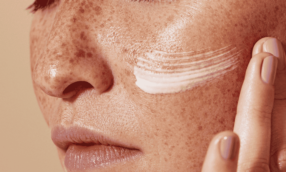 marketing treatments for skin pigmentation