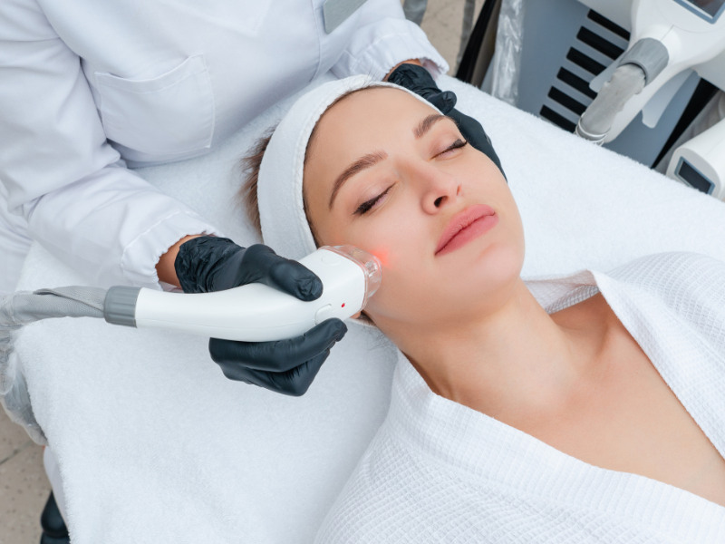 laser skin resurfacing